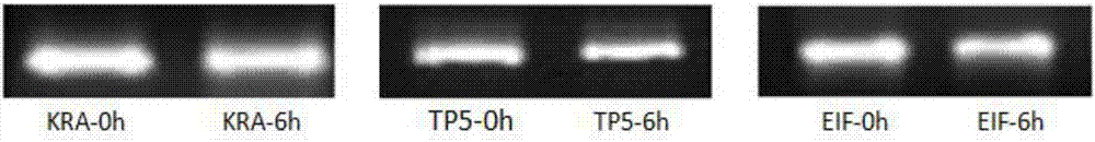 Oligonucleotide molecule used for inhibiting mRNA expression of EIF4E target gene and set composition thereof