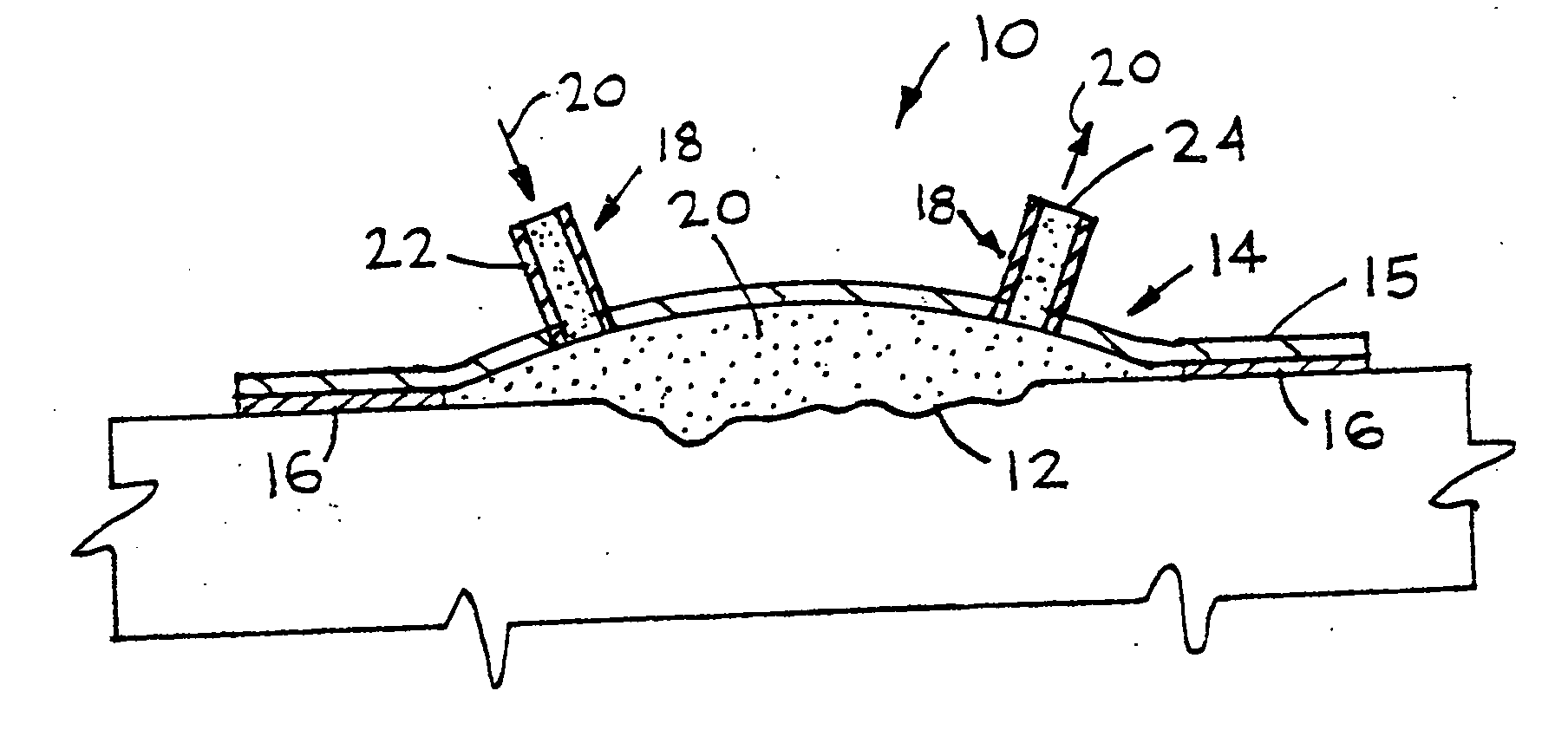 Device for treating and promoting healing of damaged body tissue