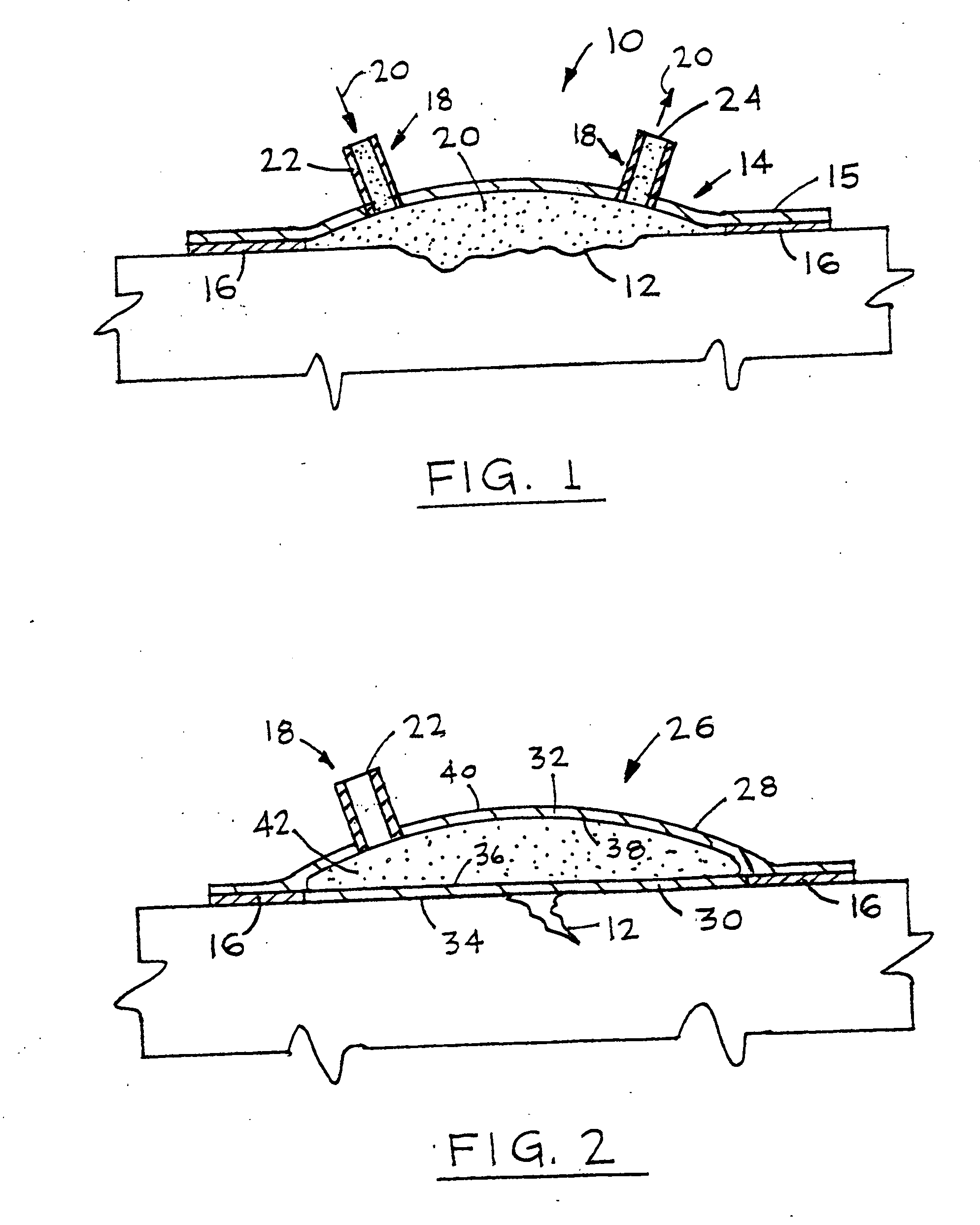 Device for treating and promoting healing of damaged body tissue