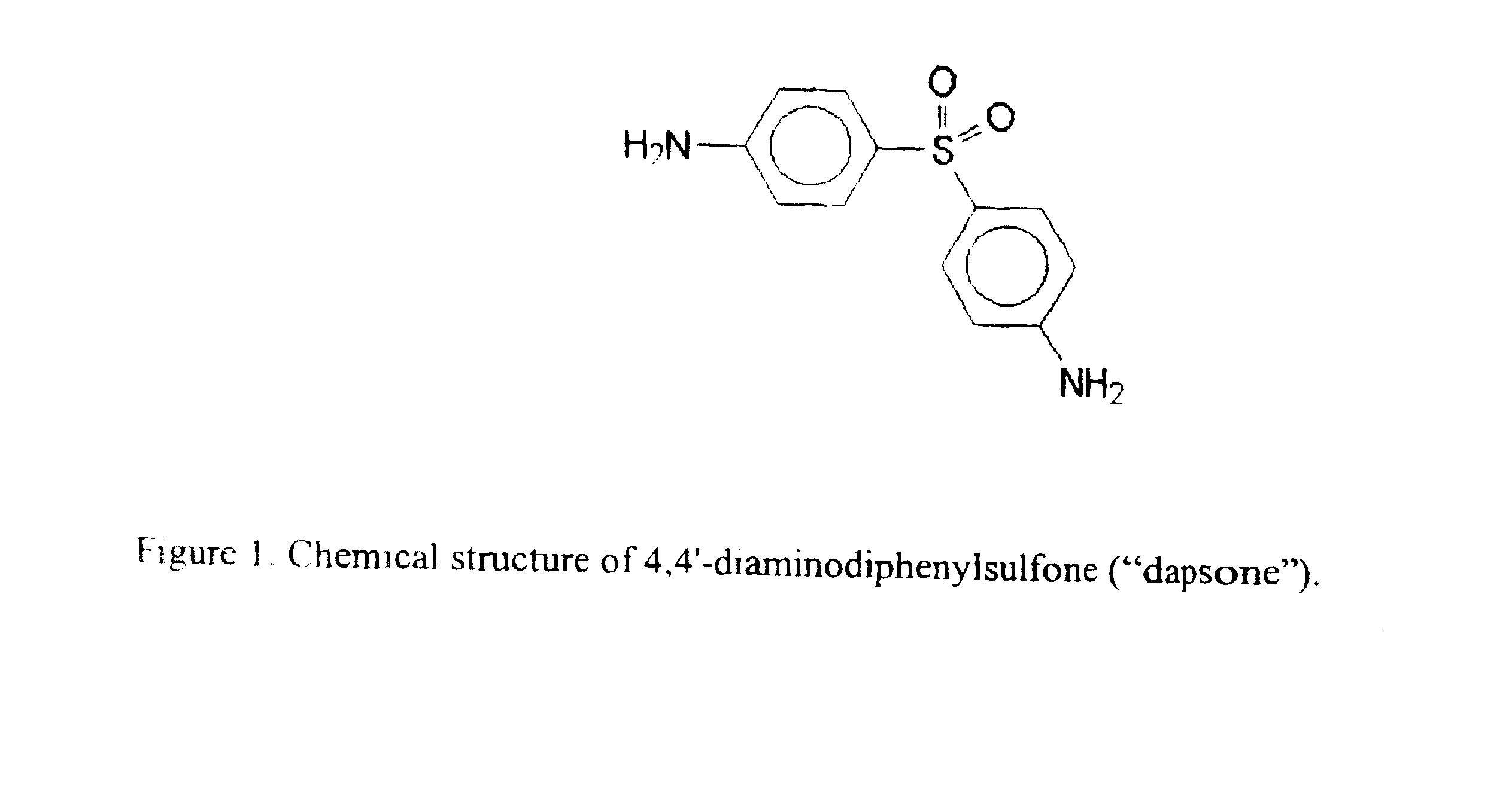 Galenical preparations of dapsone and related sulphones, and method of therapeutic and preventative treatment of disease