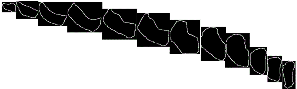 Building method of discrete element module of true aggregate particles based on X-ray CT image