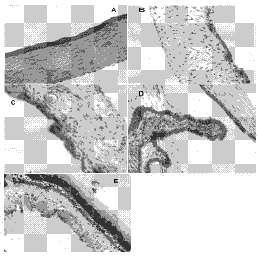 Gel for lysozyme eye and preparation method thereof