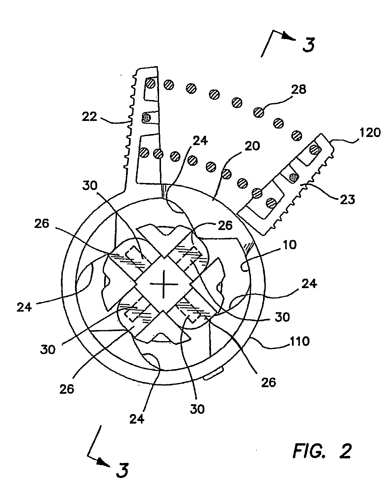 Hemostasis valve and method for assembling same