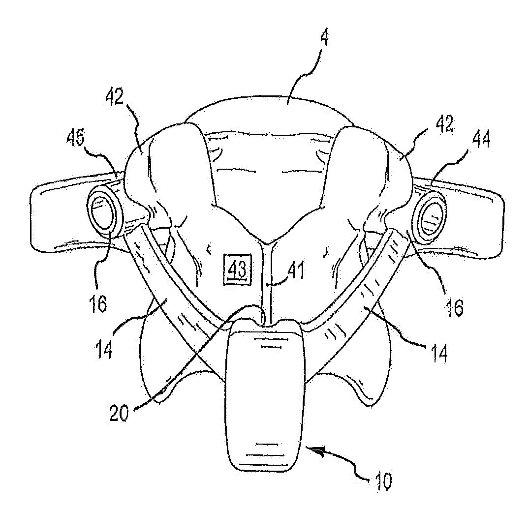 Patient-matched apparatus and methods for performing surgical procedures