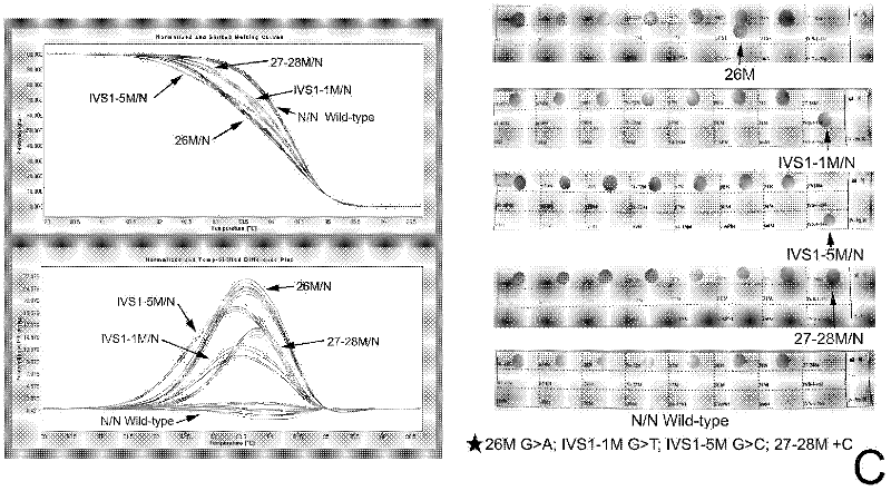 Real-time fluorescence quantitative PCR(Polymerase Chain Reaction) detection primers and kit for thalassemia