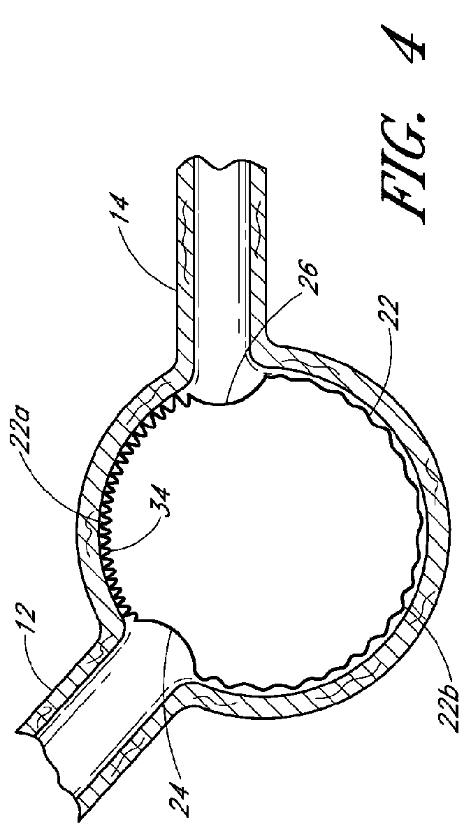 Apparatus and method of placement of a graft or graft system