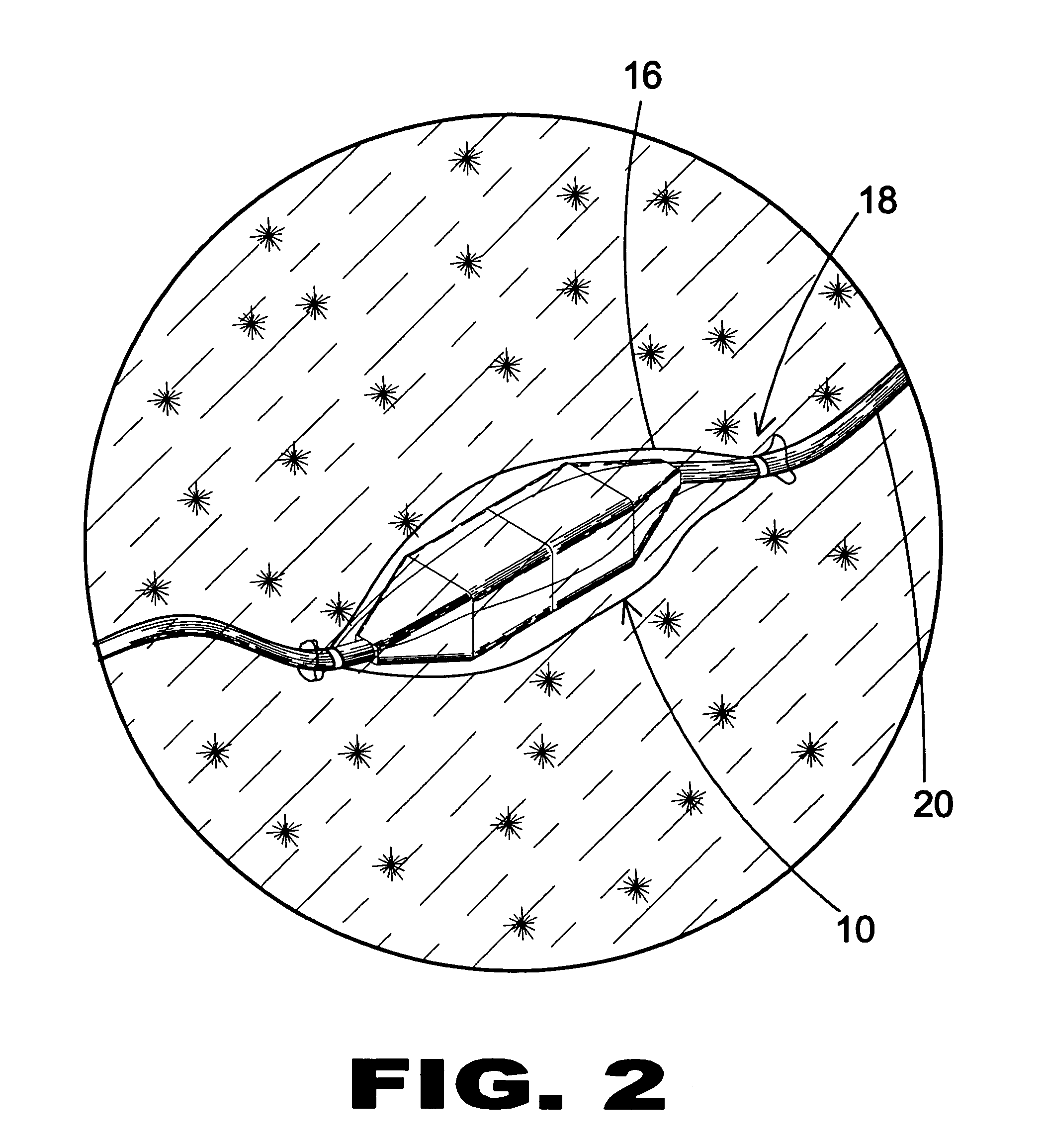 System for outdoor electrical protection