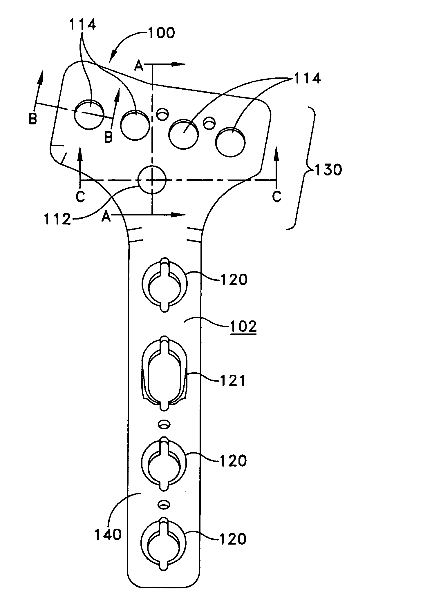 Distal radius bone plating system with locking and non-locking screws