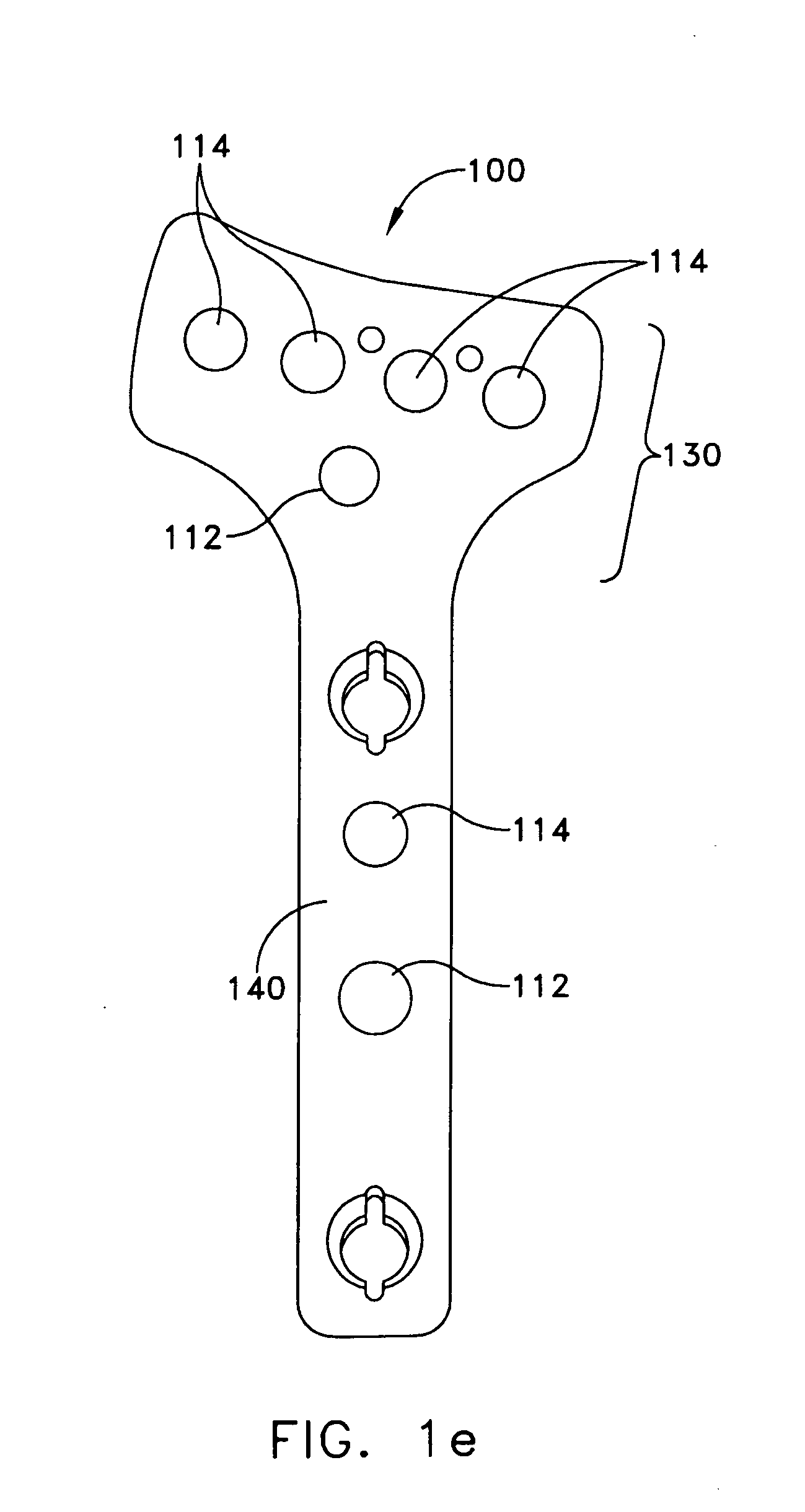 Distal radius bone plating system with locking and non-locking screws