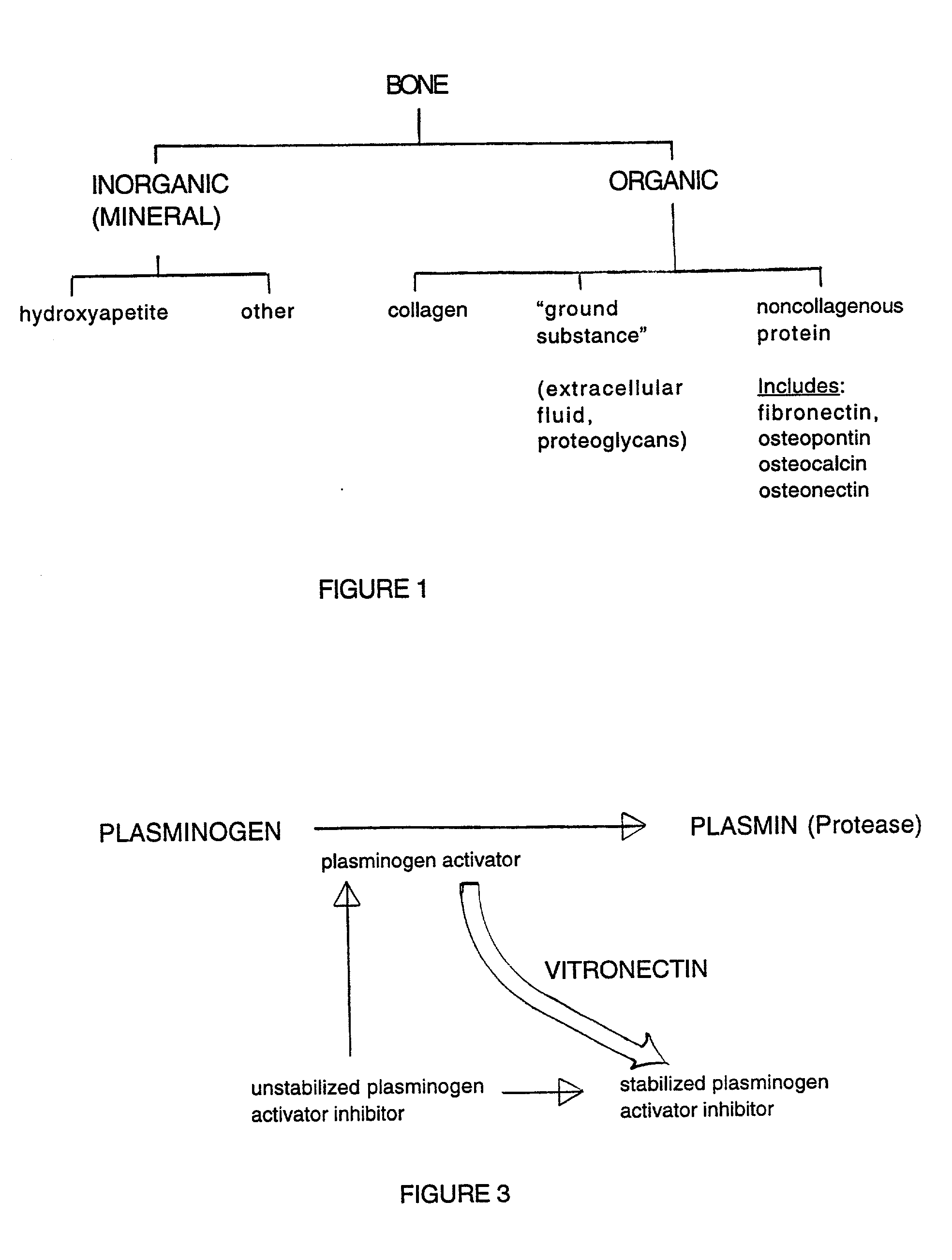 Composition and method for bone regeneration