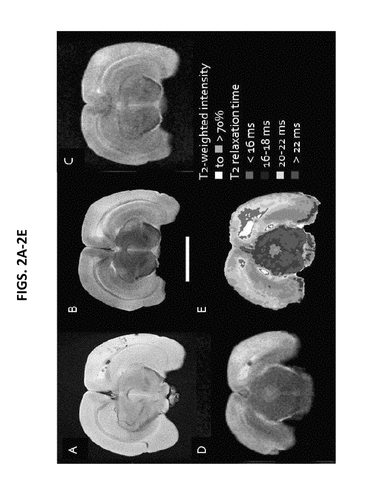 Anti-DEspR monoclonal antibody targeted therapy and imaging for cancer and stroke