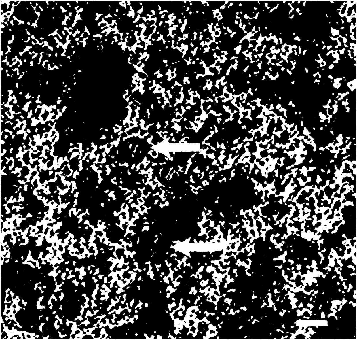 Application of mesenchymal stem cell exosome in preparation of osteoporosis prevention and treatment drug