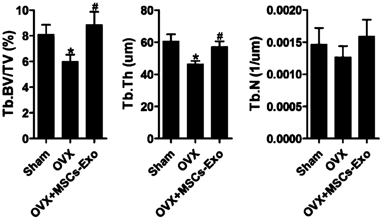 Application of mesenchymal stem cell exosome in preparation of osteoporosis prevention and treatment drug