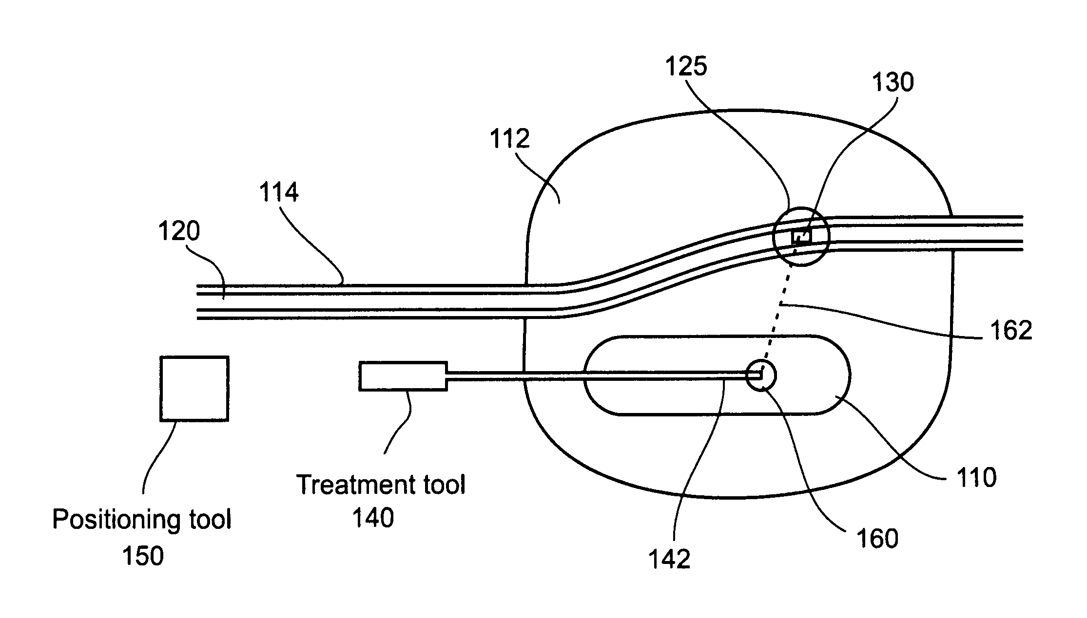 Method and apparatus for positioning a surgical instrument