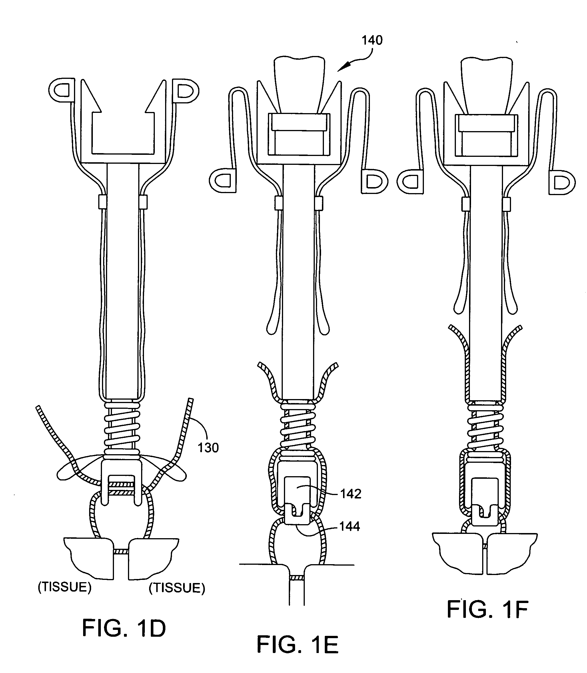 Weldable flexible longitudinal fixation components and instruments associated therewith