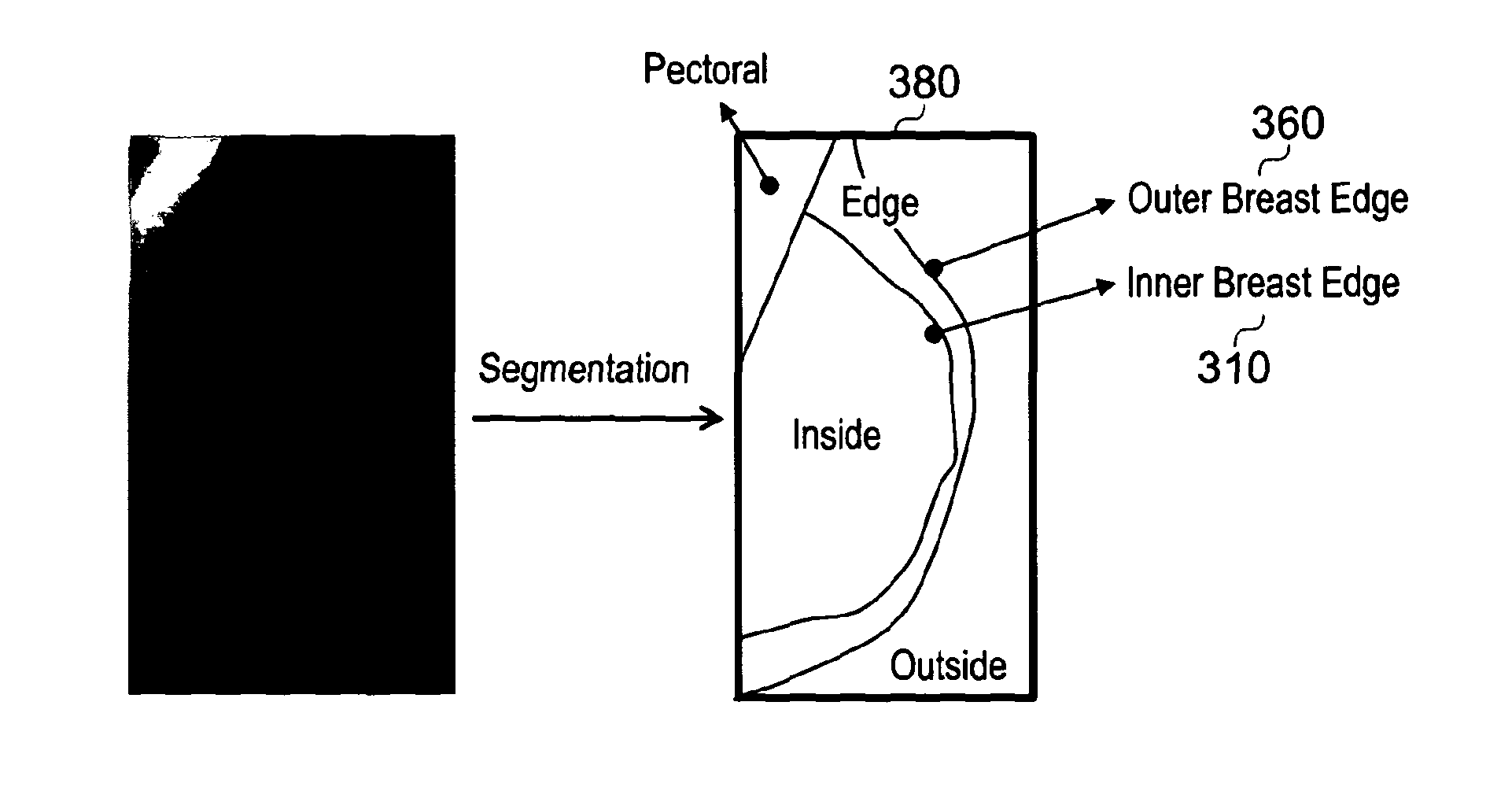 Method and system for analysing tissue from images