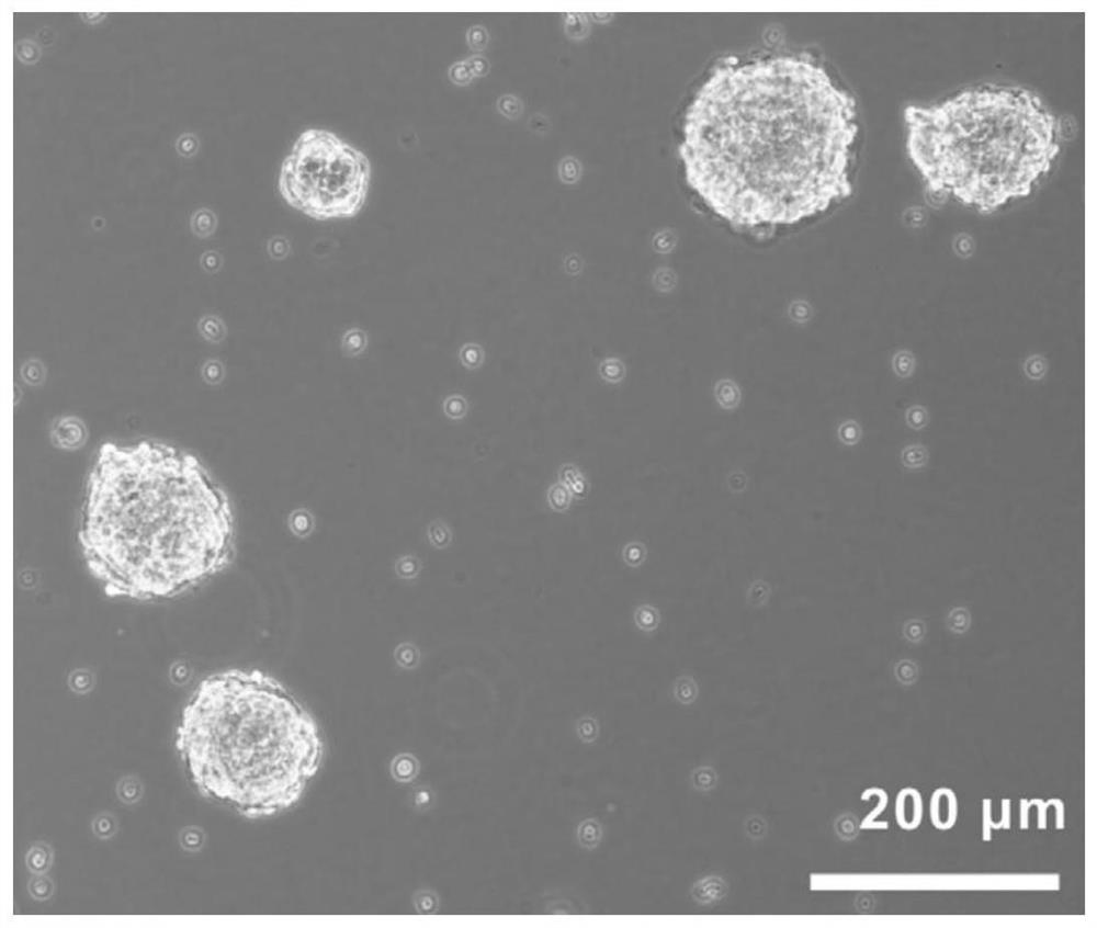 Application of components in promoting in-vitro proliferation of neural stem cells and further in neural stem cell transplantation