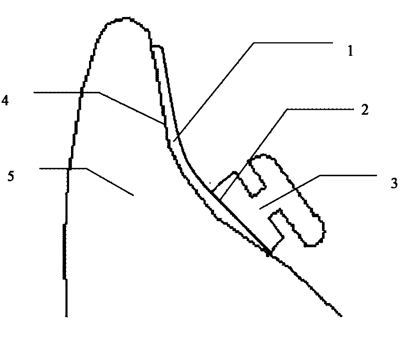 Computer-aided design (CAD) and computer-aided manufacturing (CAM) personalized substrate sandwich ceramic bracket and manufacturing method thereof