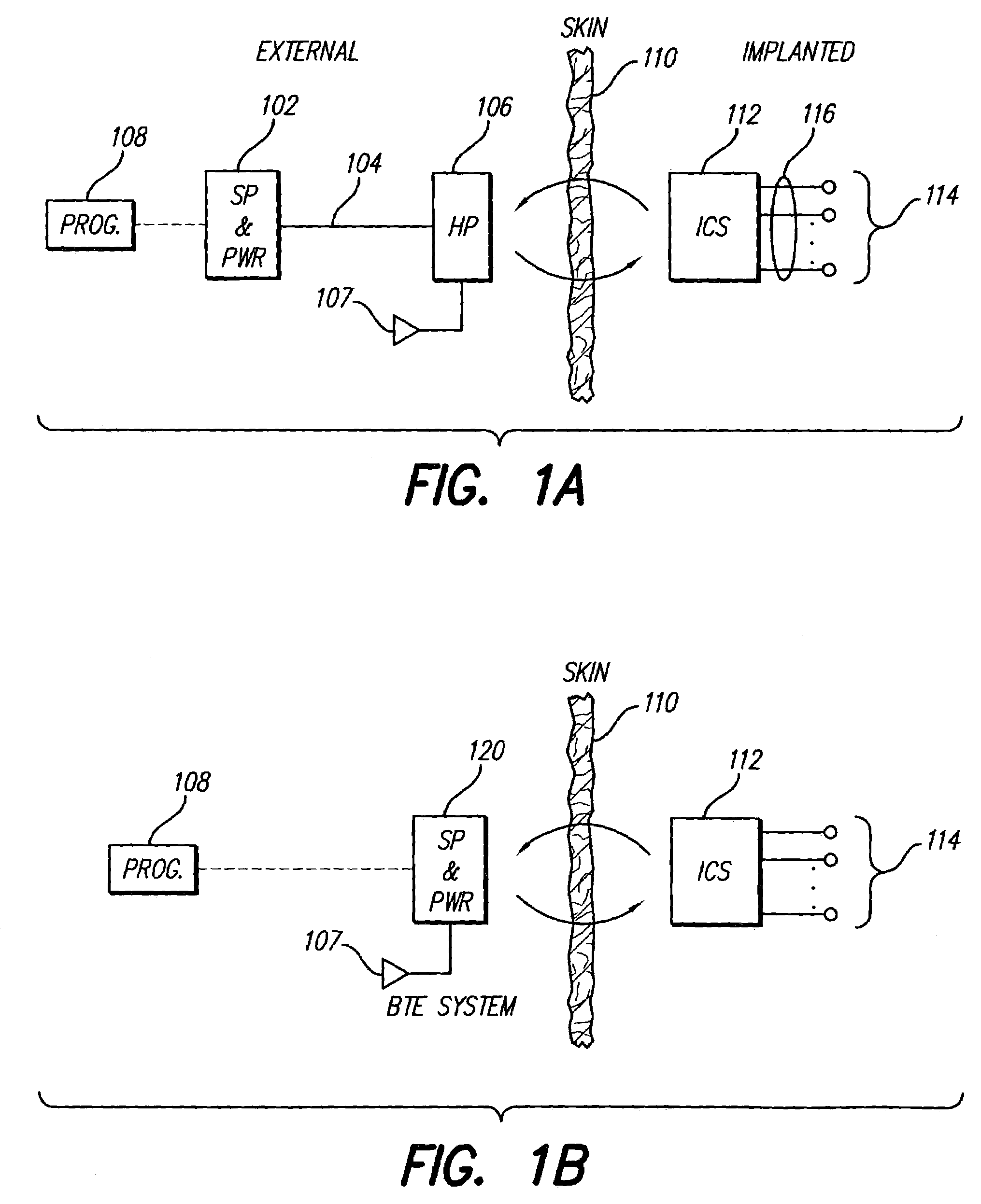 Partitioned implantable system