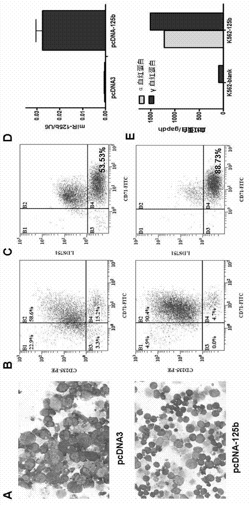 Application of miR-125b in red blood cell maturation