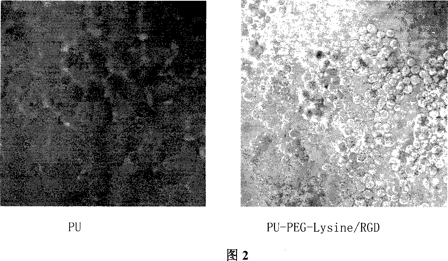 Polyurethane material for improving adhering growing of cells and rombolytic function