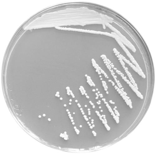 Metschnikowia pulcherrima with high esterase activity and application of metschnikowia pulcherrima in fermentation of hydromel