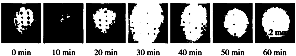 Microneedle patch and preparing method thereof