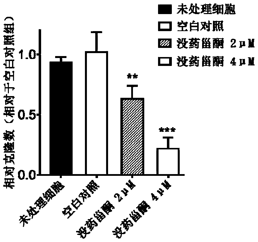 Application of guggulsterone in preparation of medicine for treating psoriasis