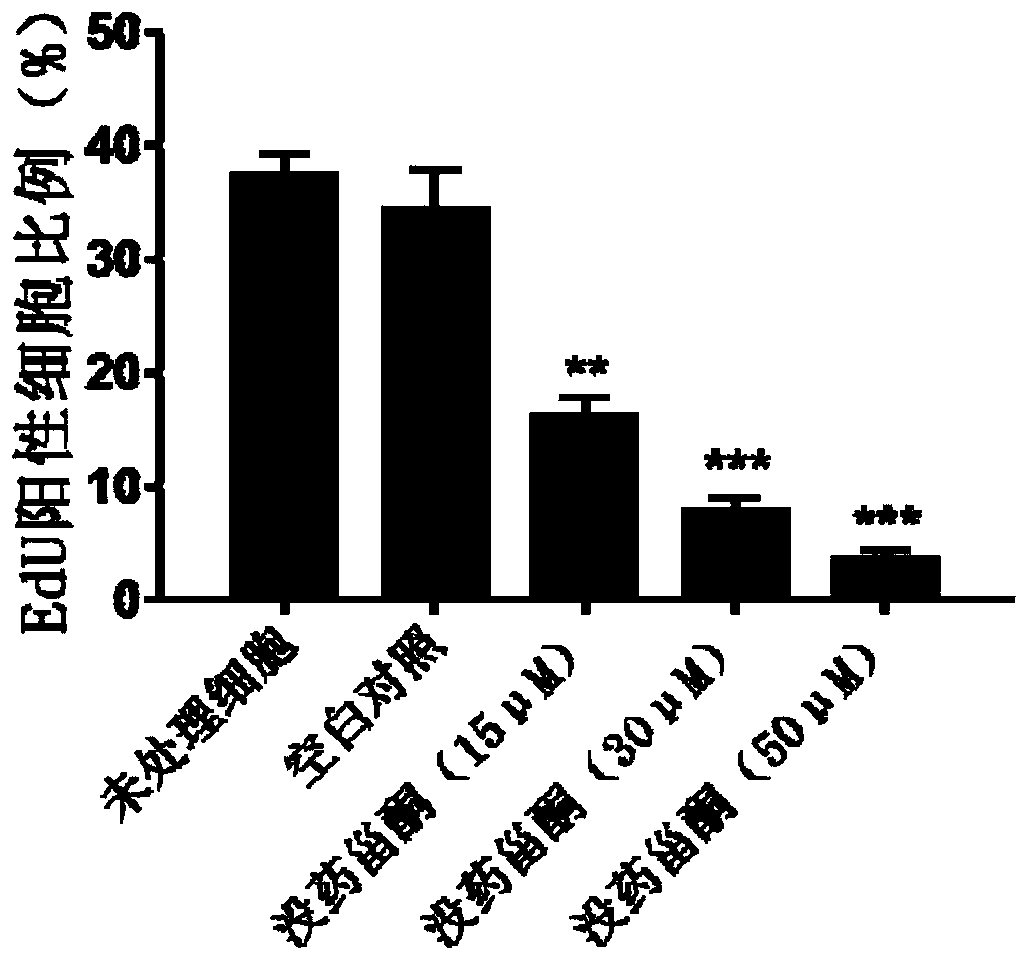 Application of guggulsterone in preparation of medicine for treating psoriasis