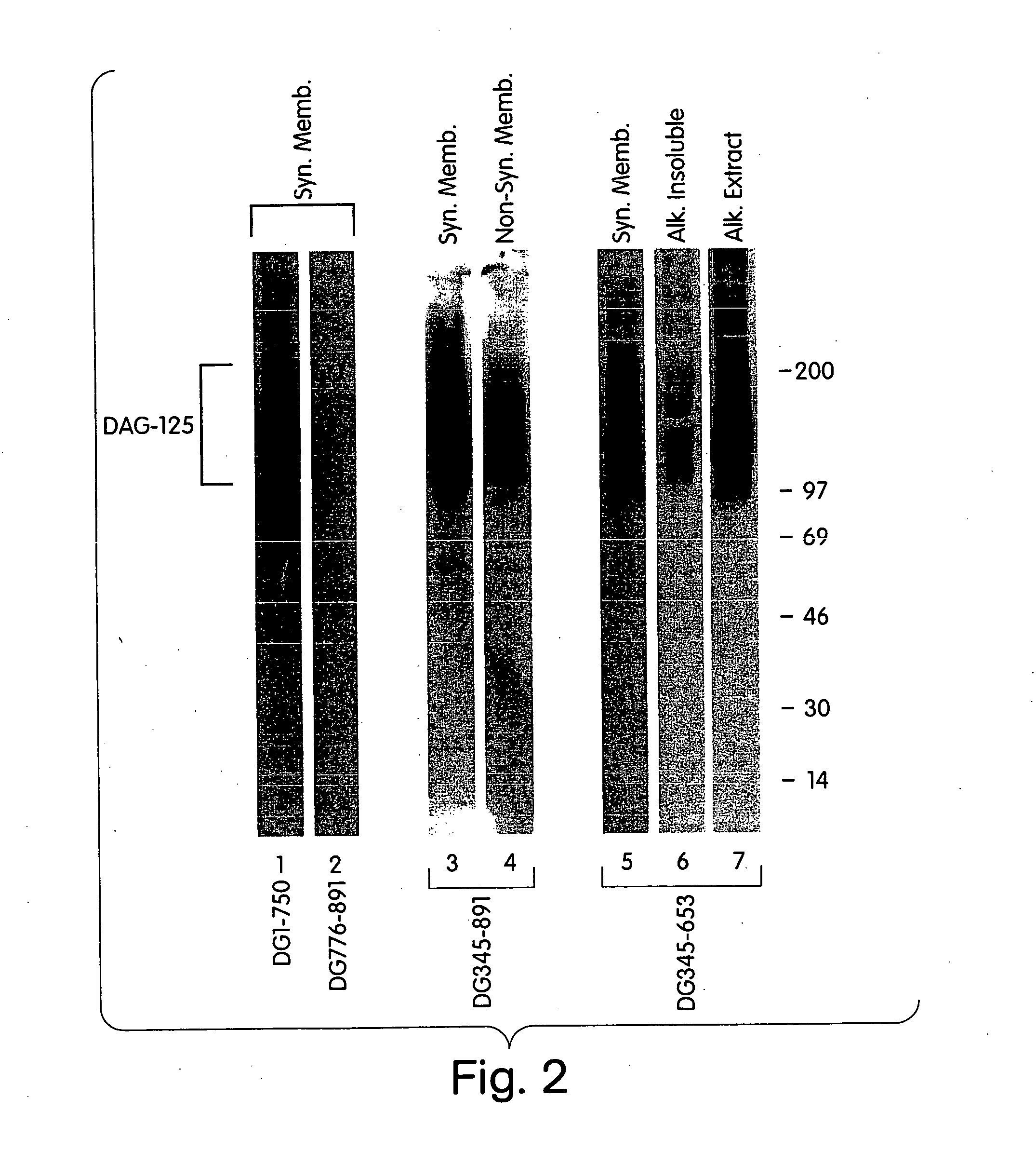 Biglycan and related therapeutics and methods of use