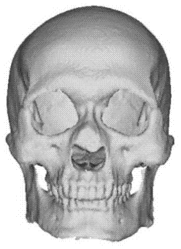 Criminology-oriented computer-assisted facial reconstruction method for skulls of unknown body sources