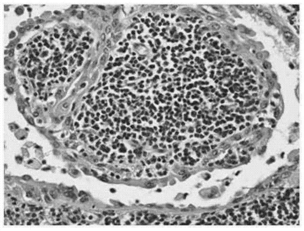 Eosin staining solution and HE staining solution containing same