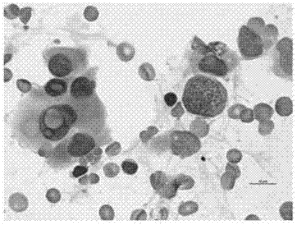 Eosin staining solution and HE staining solution containing same