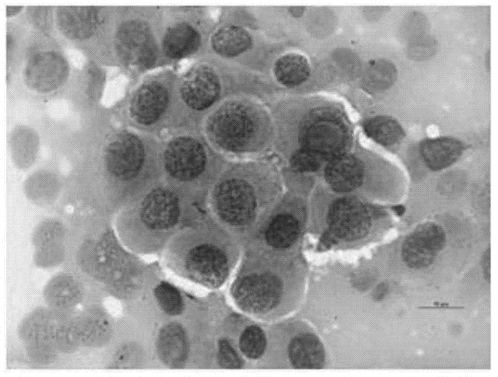 Eosin staining solution and HE staining solution containing same