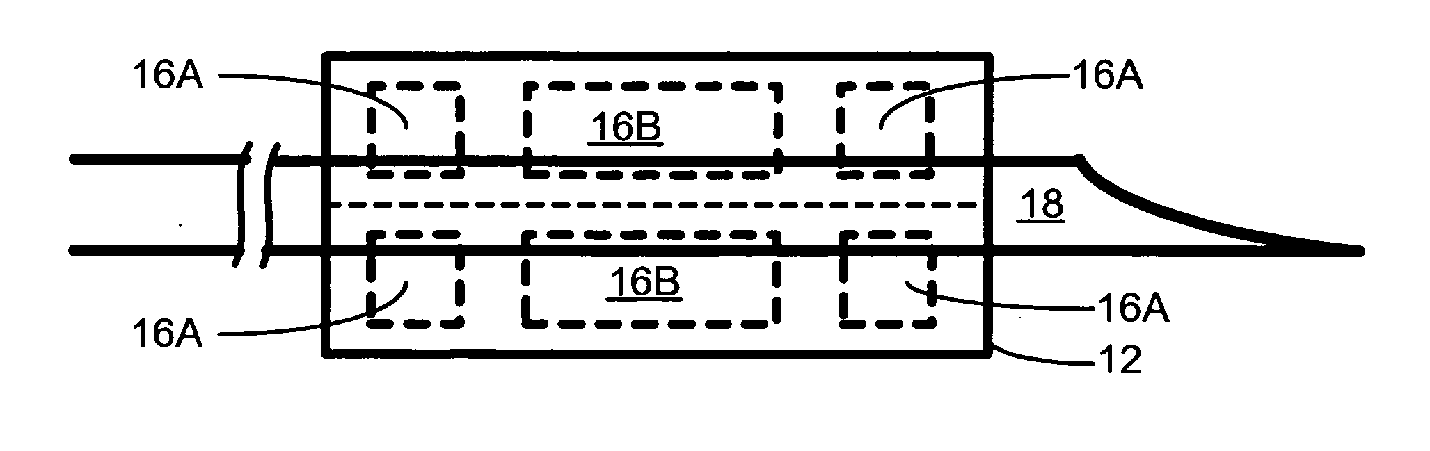 Apparatus and method for image guided insertion and removal of a cannula or needle