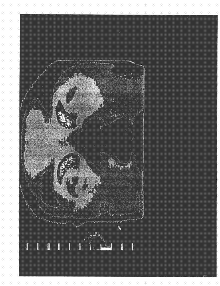 Appartus and method for measuring biologic parameters