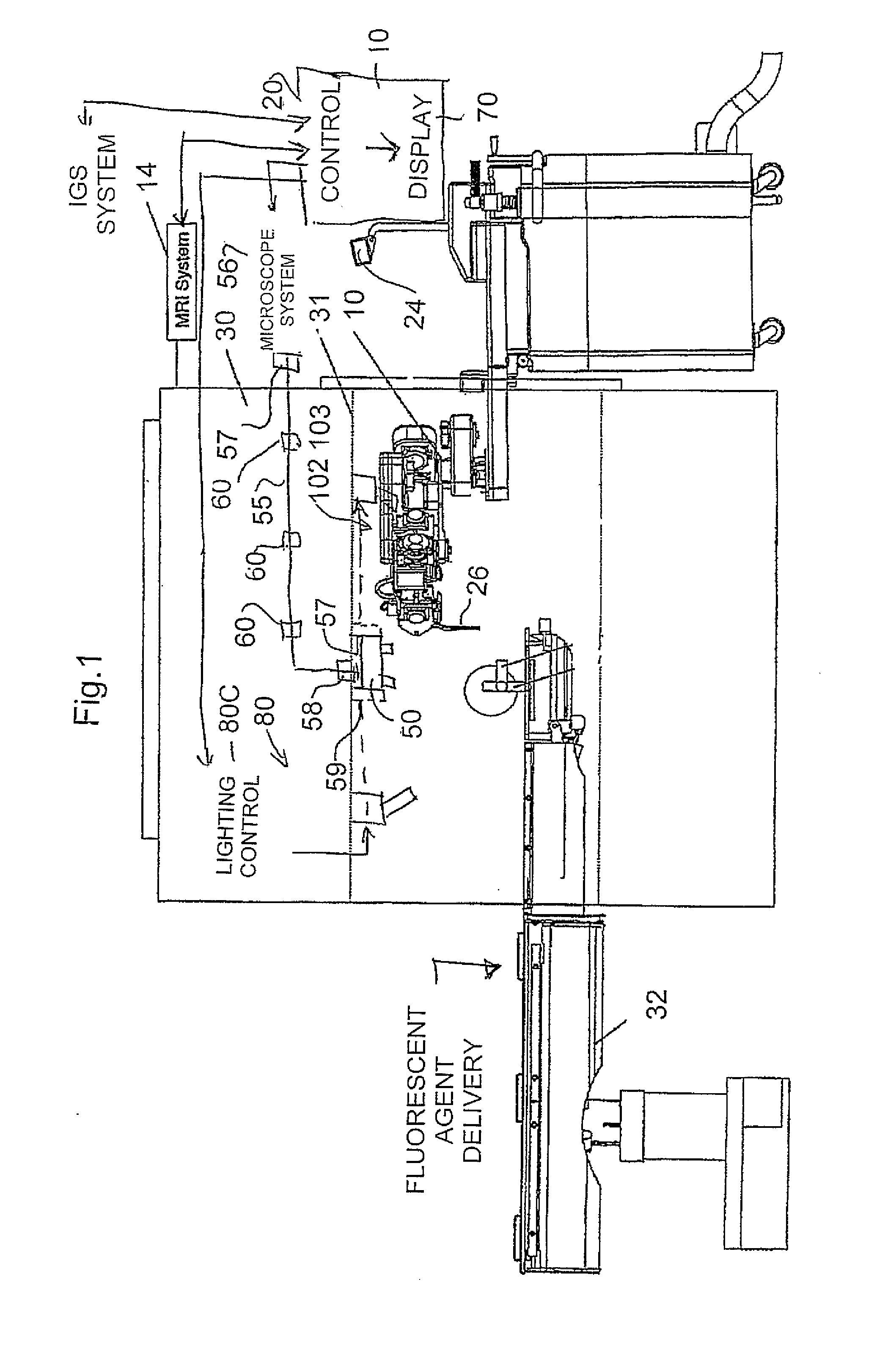 MR Compatible Fluorescence Viewing Device for use in the Bore of an MR Magnet