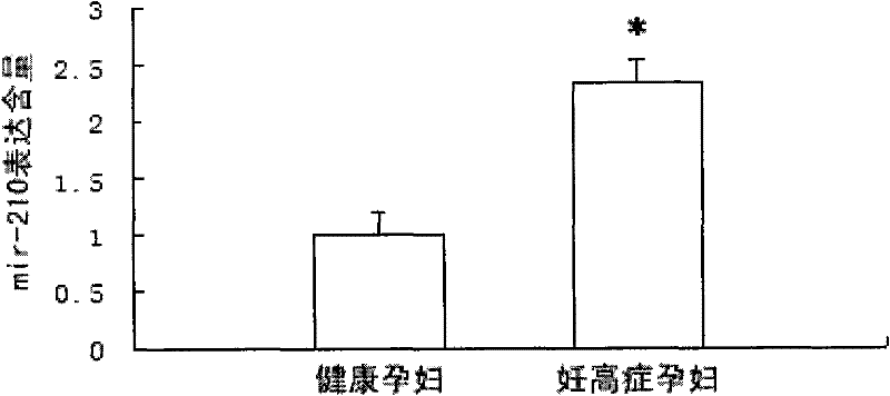 Hsa-mir-210 kit and detection method for detection of pregnancy-induced hypertension syndrome