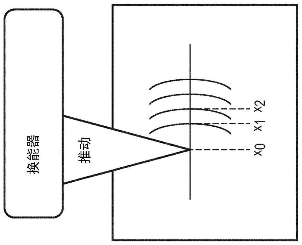 Intelligent guided wave elastography