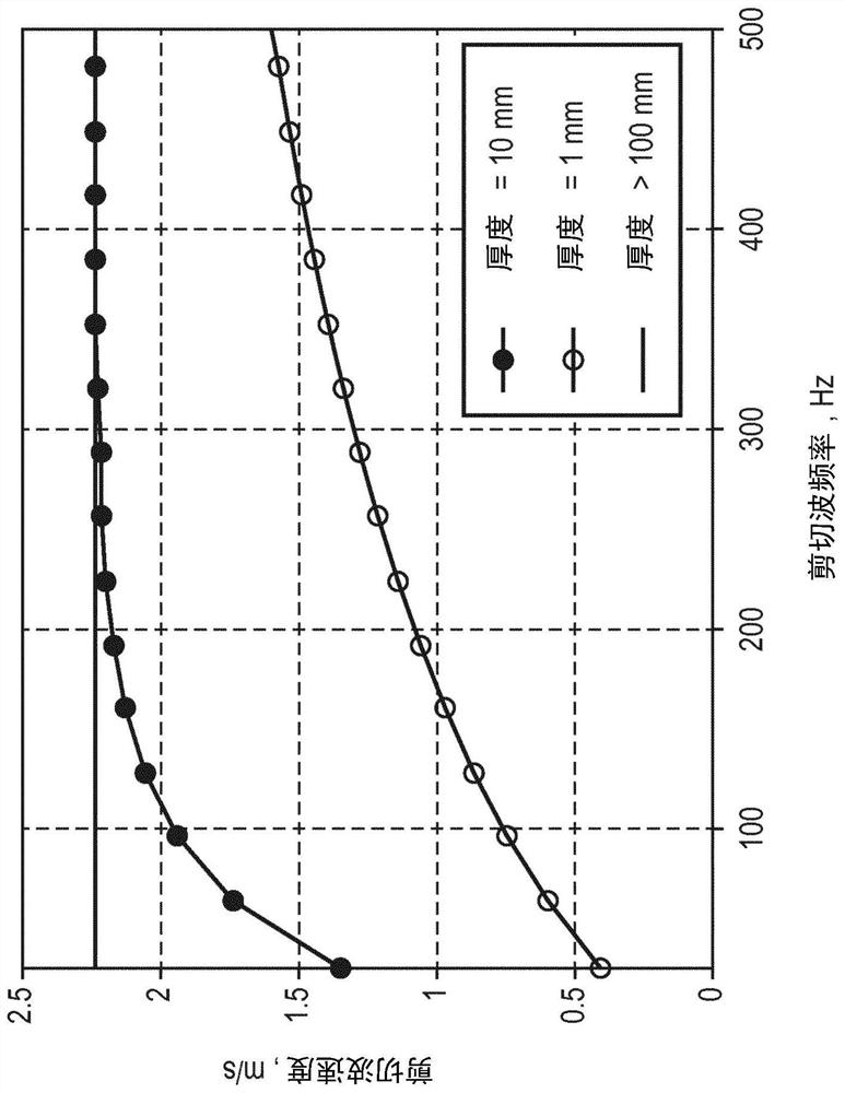 Intelligent guided wave elastography