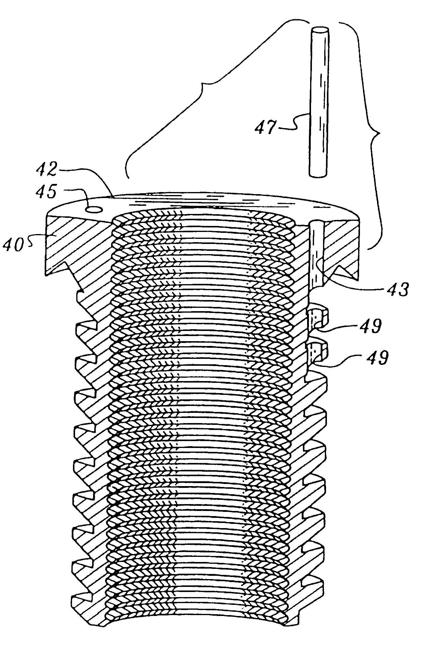 Insert retention mechanism