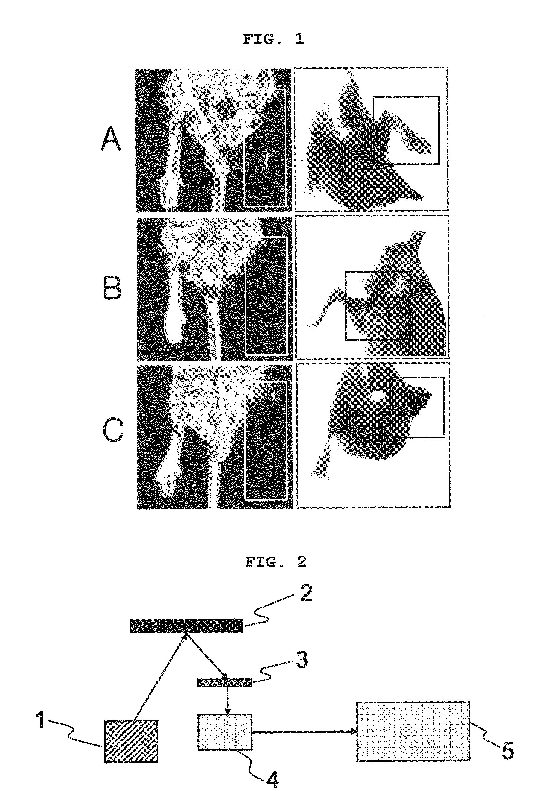 System for analyzing tissue perfusion using concentration of indocyanine green in blood