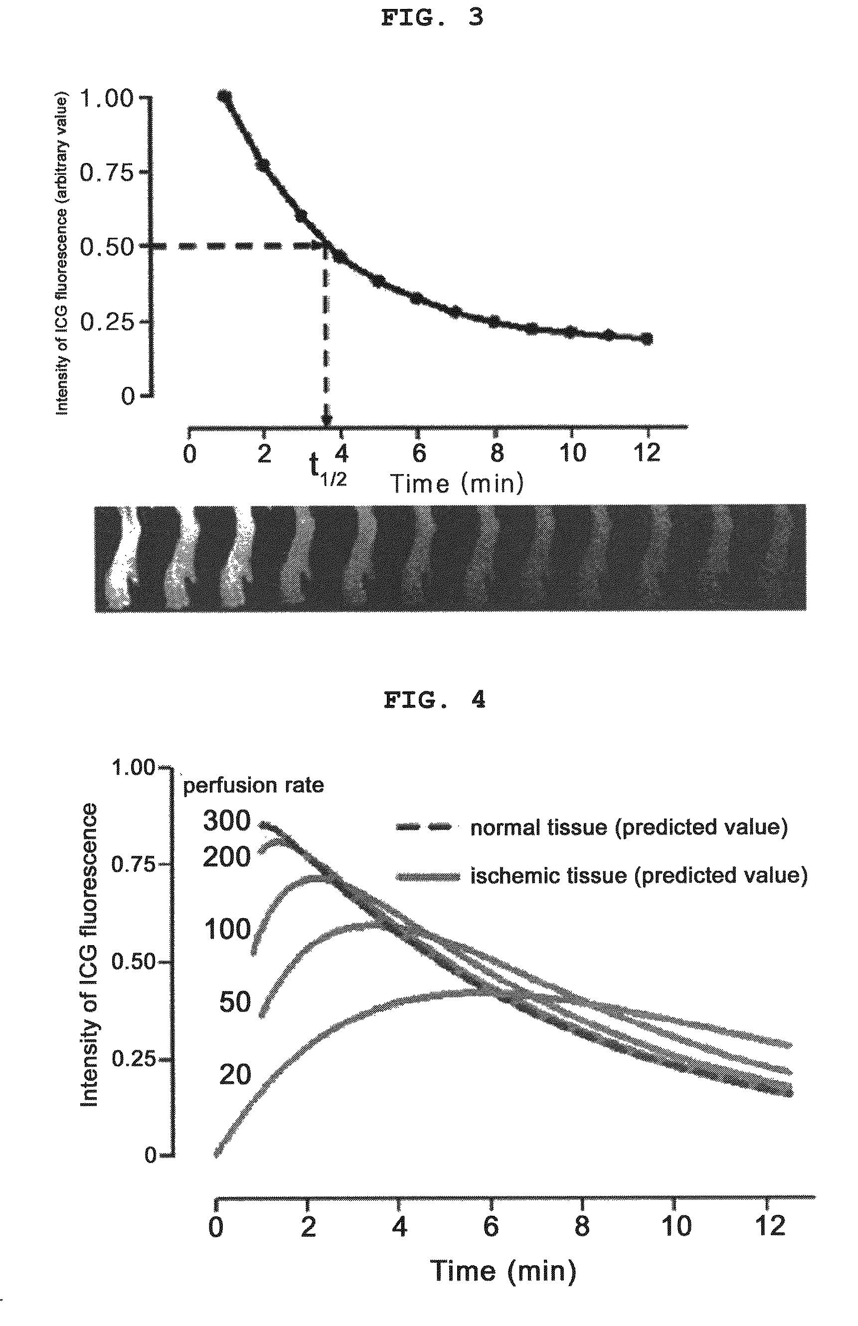 System for analyzing tissue perfusion using concentration of indocyanine green in blood