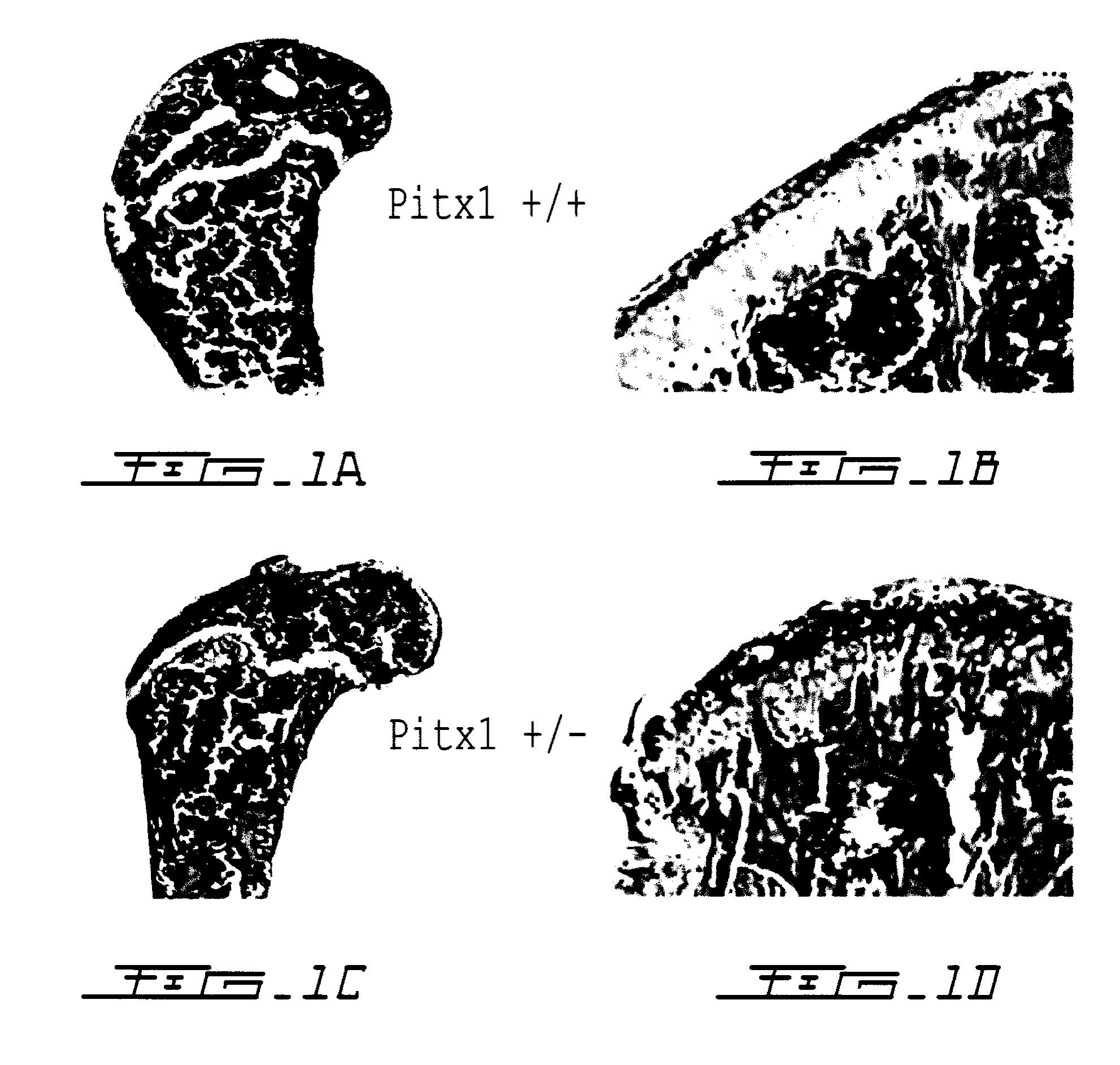 Methods for diagnosing osteoarthritis