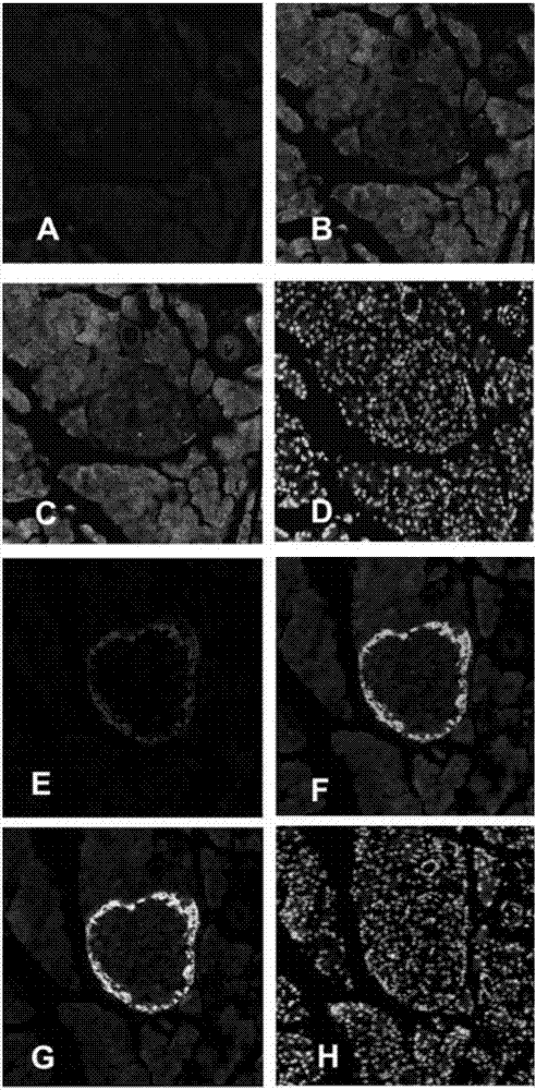 Application of pancreatic GnRH receptor function regulator to preparation of drugs used for treating type 2 diabetes