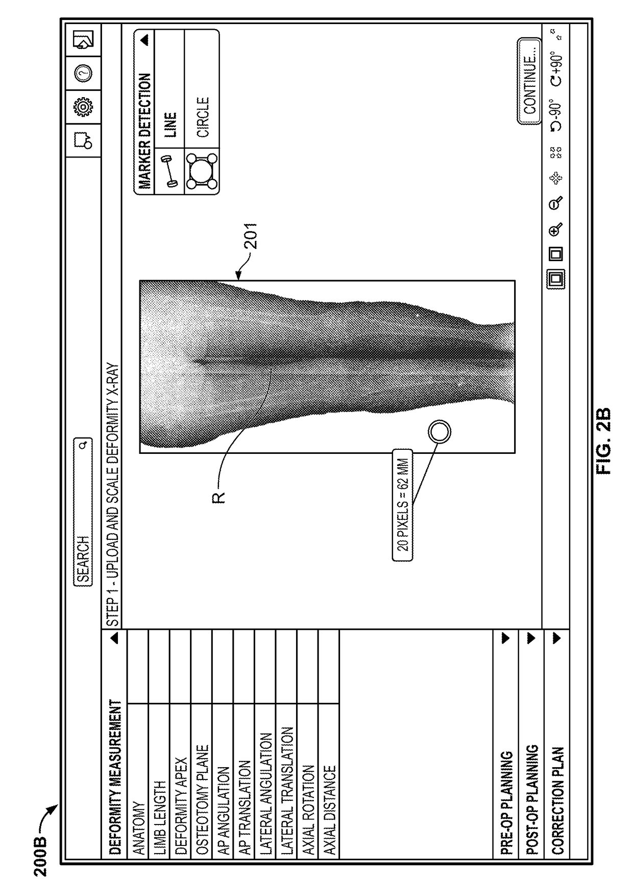 Software for use with deformity correction