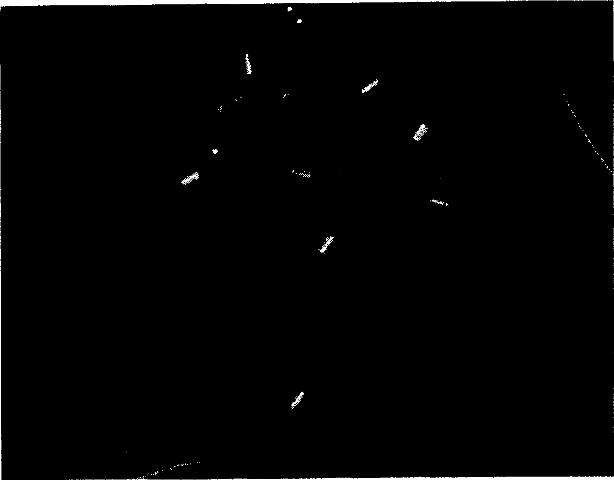 3CL protease inhibitor of non-peptide SARS coronavirus and use thereof