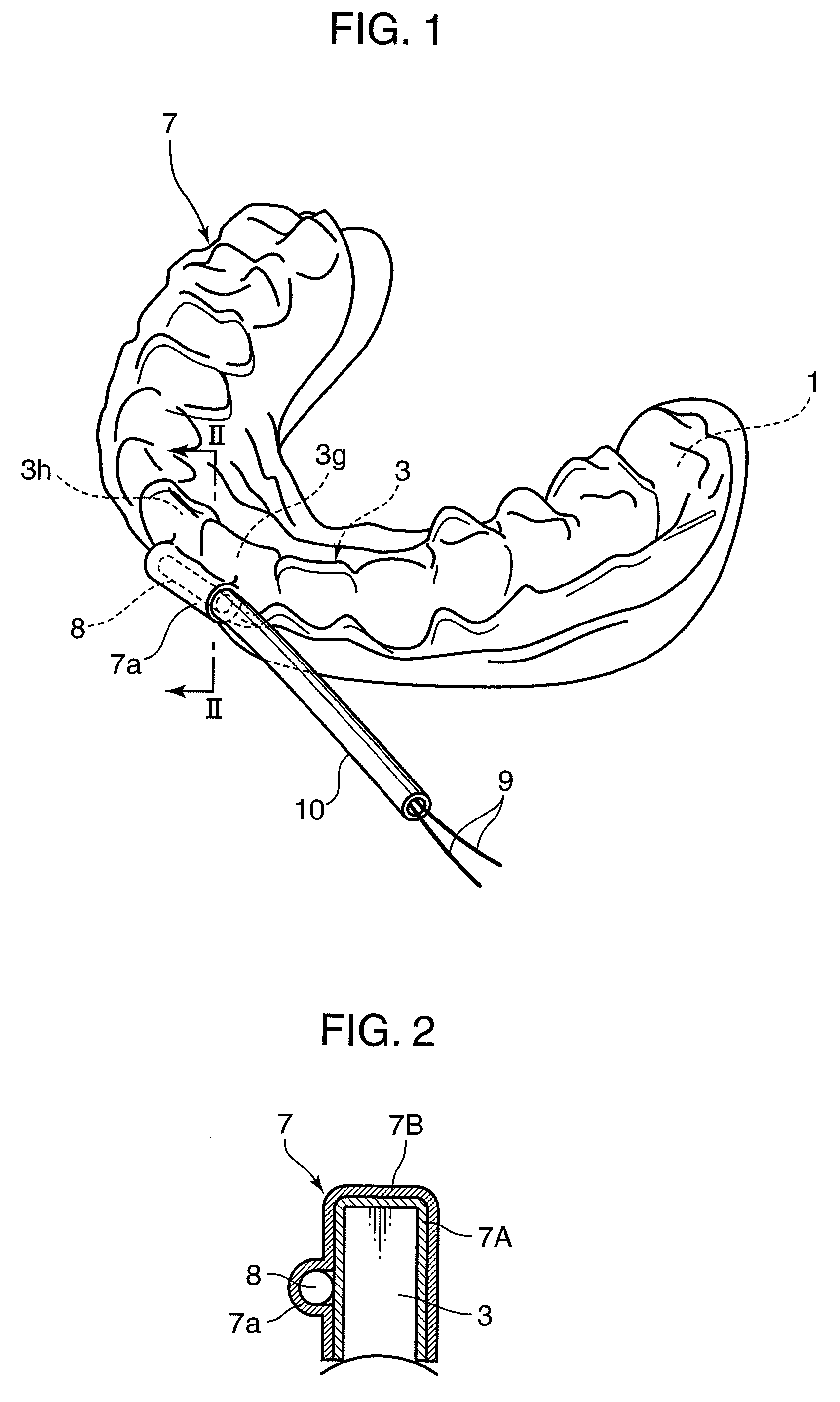 Orthodontic appliance