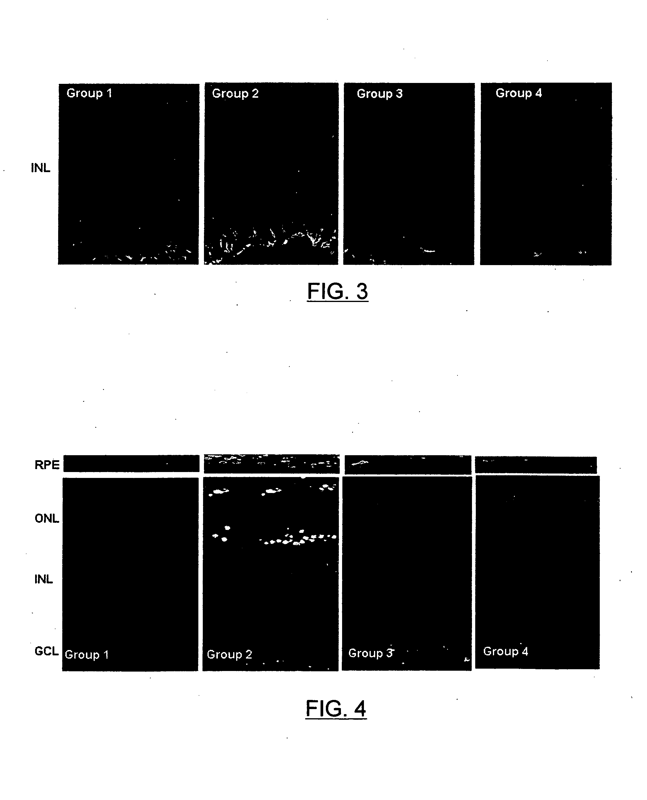 Topical ophthalmic peptide formulation