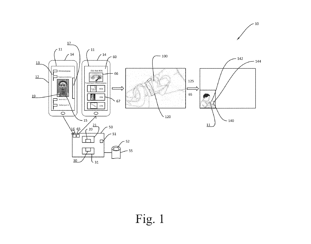 Method and System for Diagnosis and Prediction of Treatment Effectiveness for Sleep Apnea